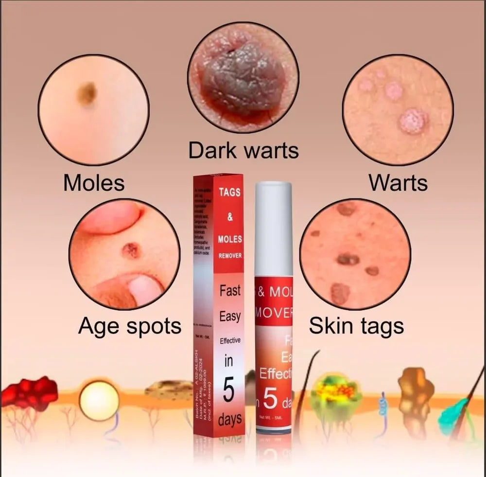 LOVILDS™ Tags & Moles Remover
